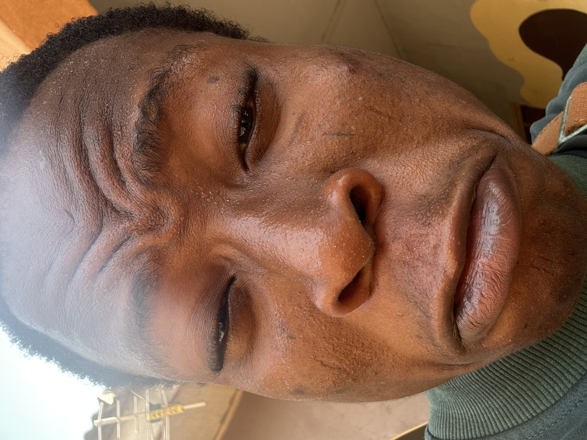 Person with perspiration observed in close-up at location 666