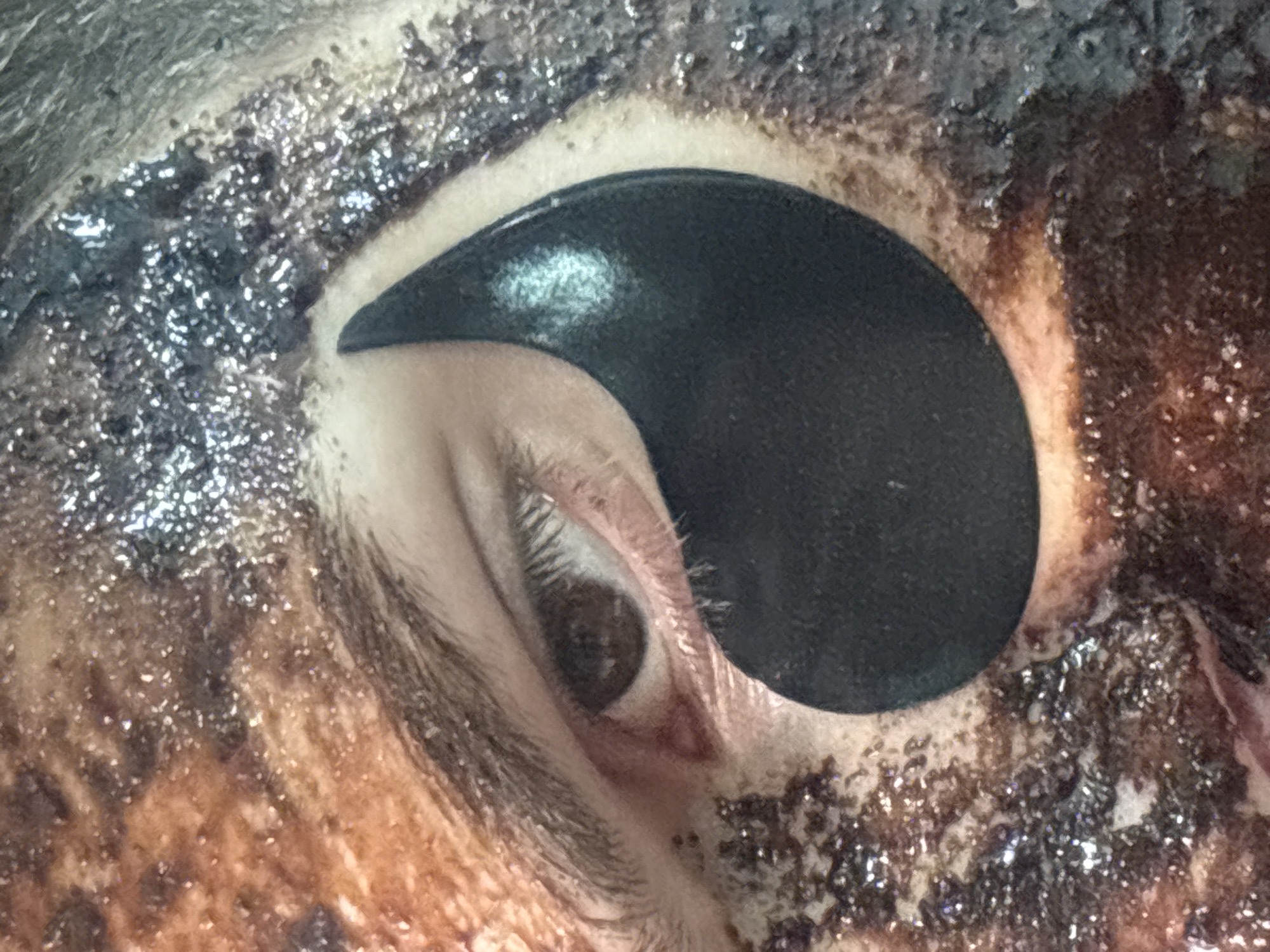 Person in eye patches photographed in Gyumri, Armenia