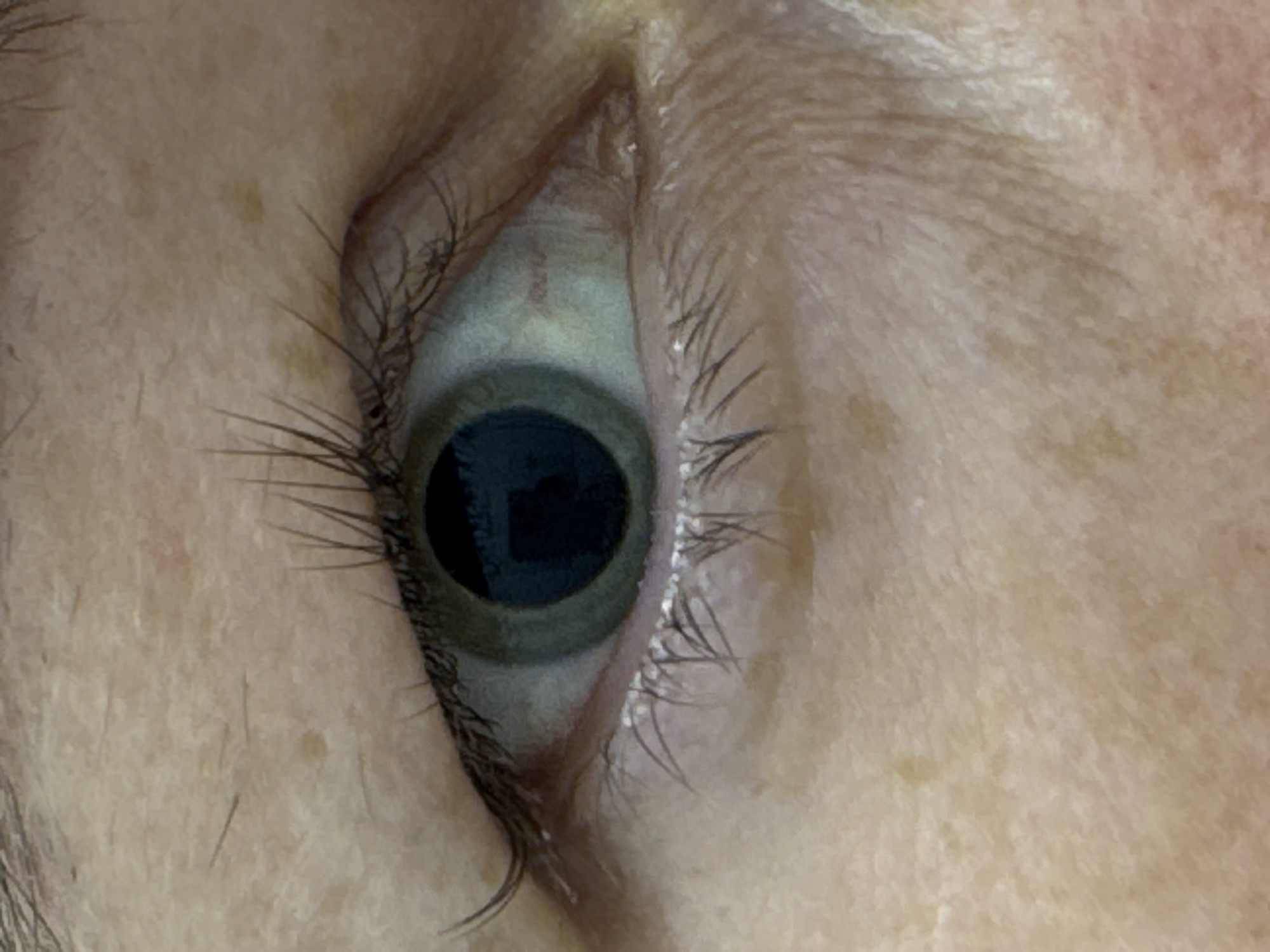 Selfies and close-up eye shots at a Chaikovsky clinic