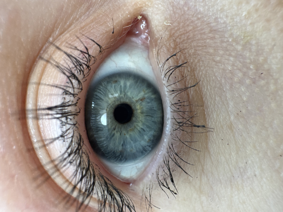 Woman photographed during dental office visit in Perm