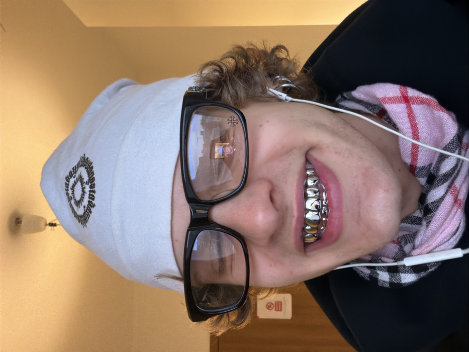 Young person photographed smiling with silver dental grill in Milan