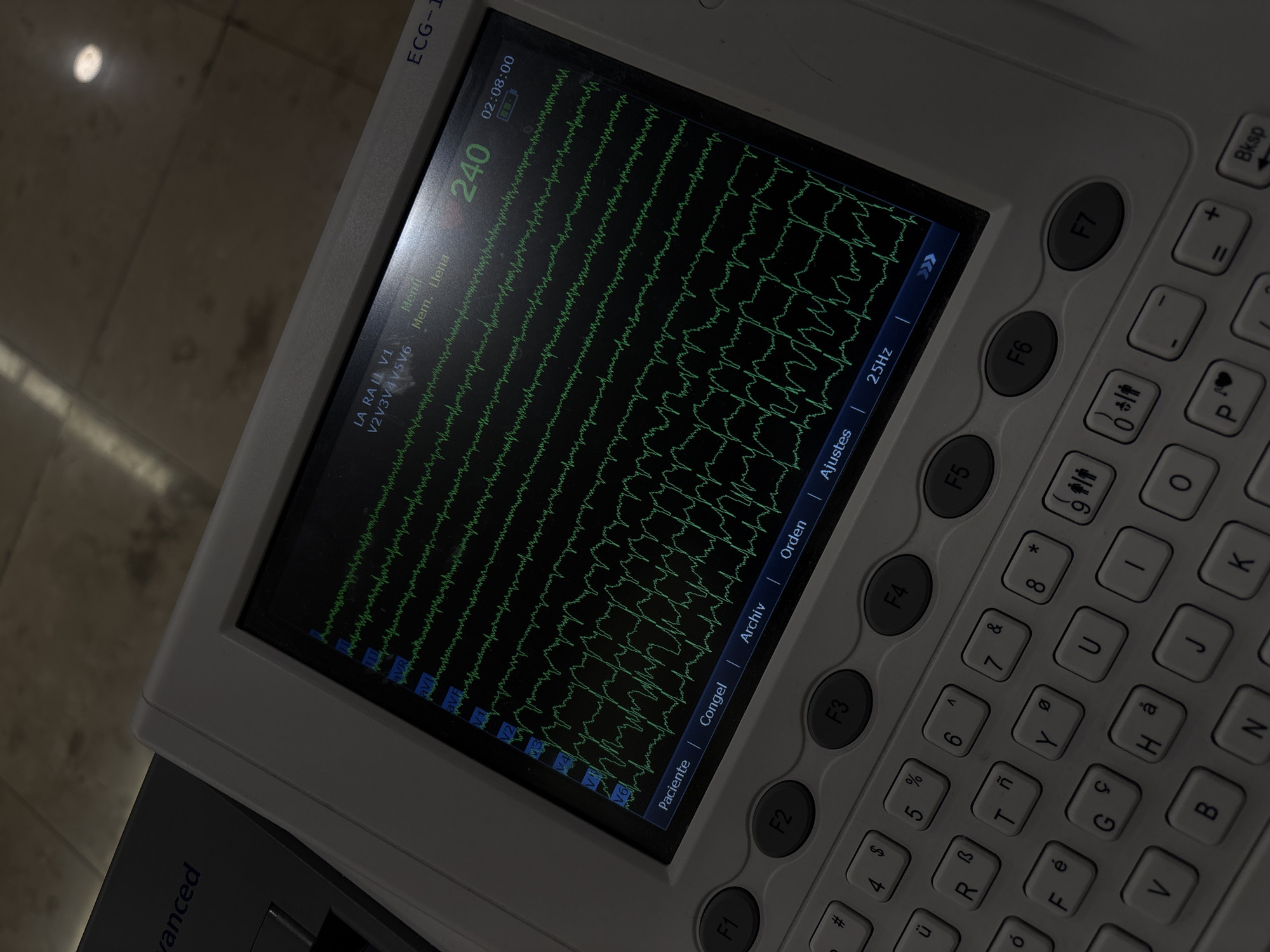 ECG machine displays heart monitoring data in Puebla