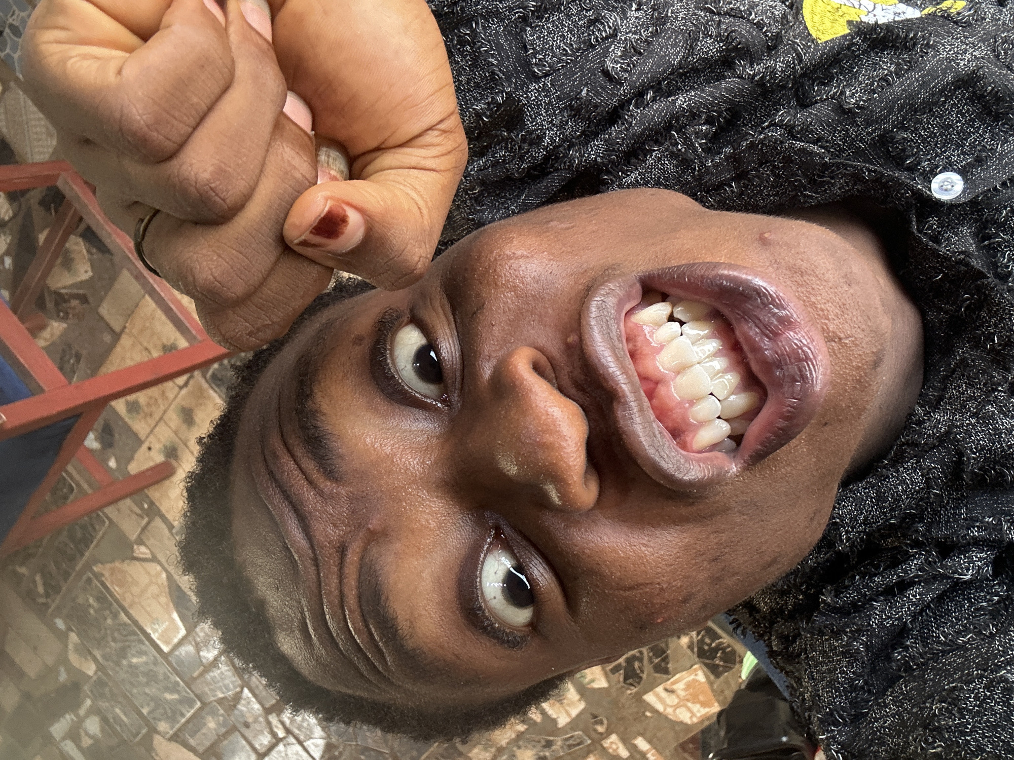 Individual photographed making animated facial expressions in series