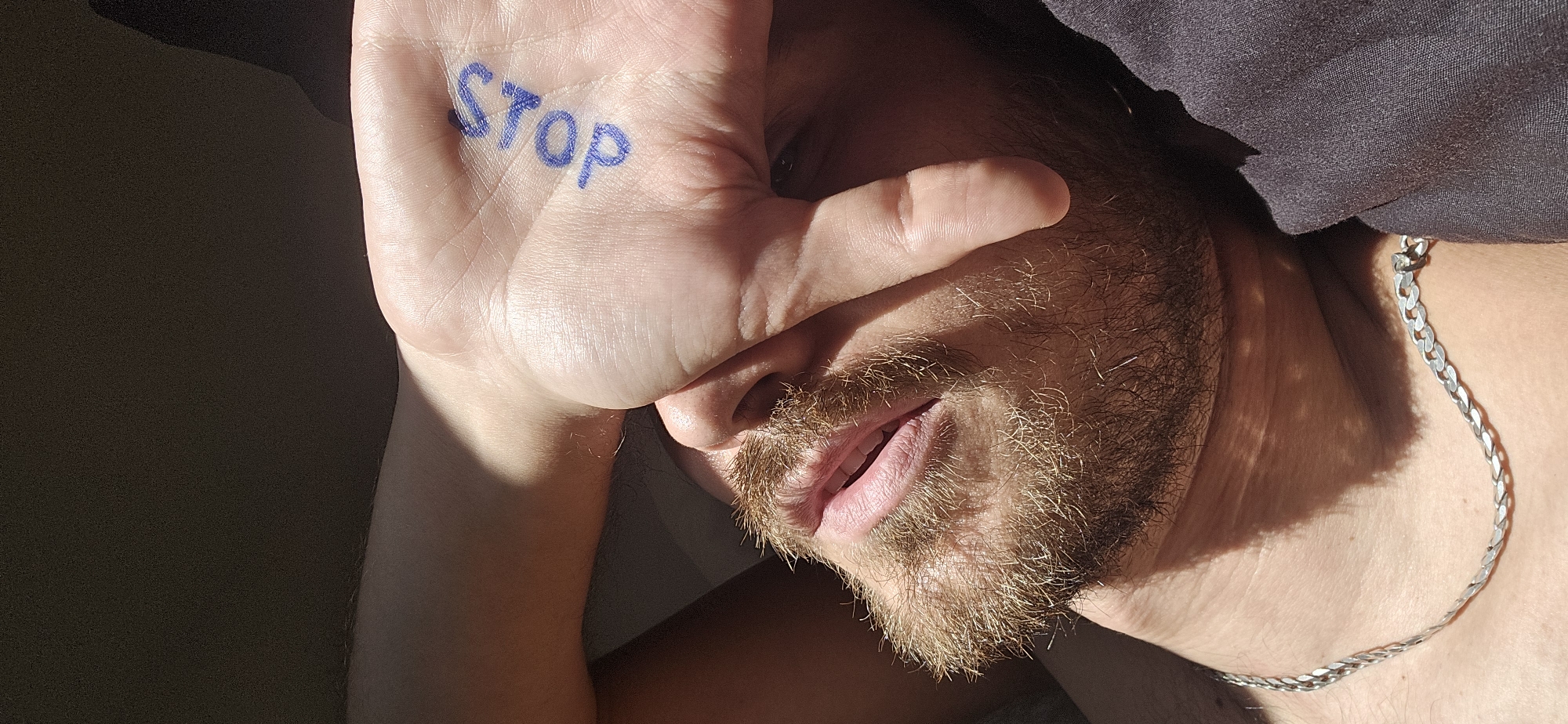 Hand with 'stop' written in marker, held over one eye