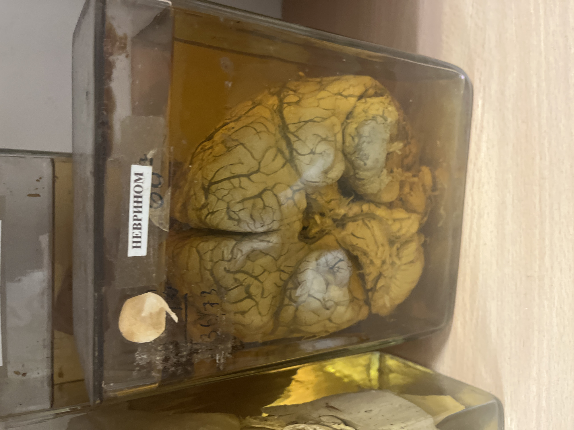 Medical University Visit Documents Anatomy Lab, Specimens in Plovdiv