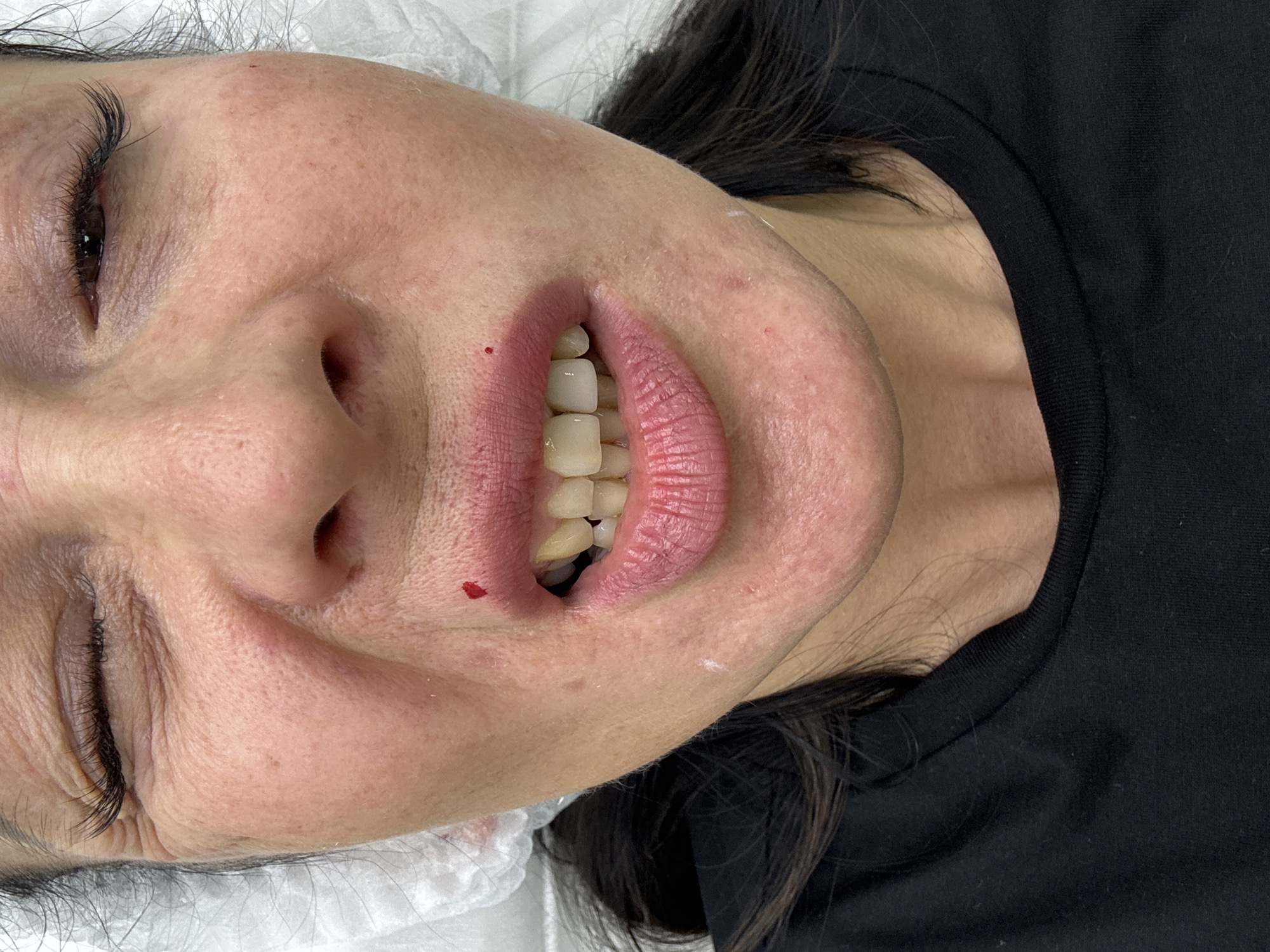 Woman receives facial injection treatment at Izhevsk medical facility