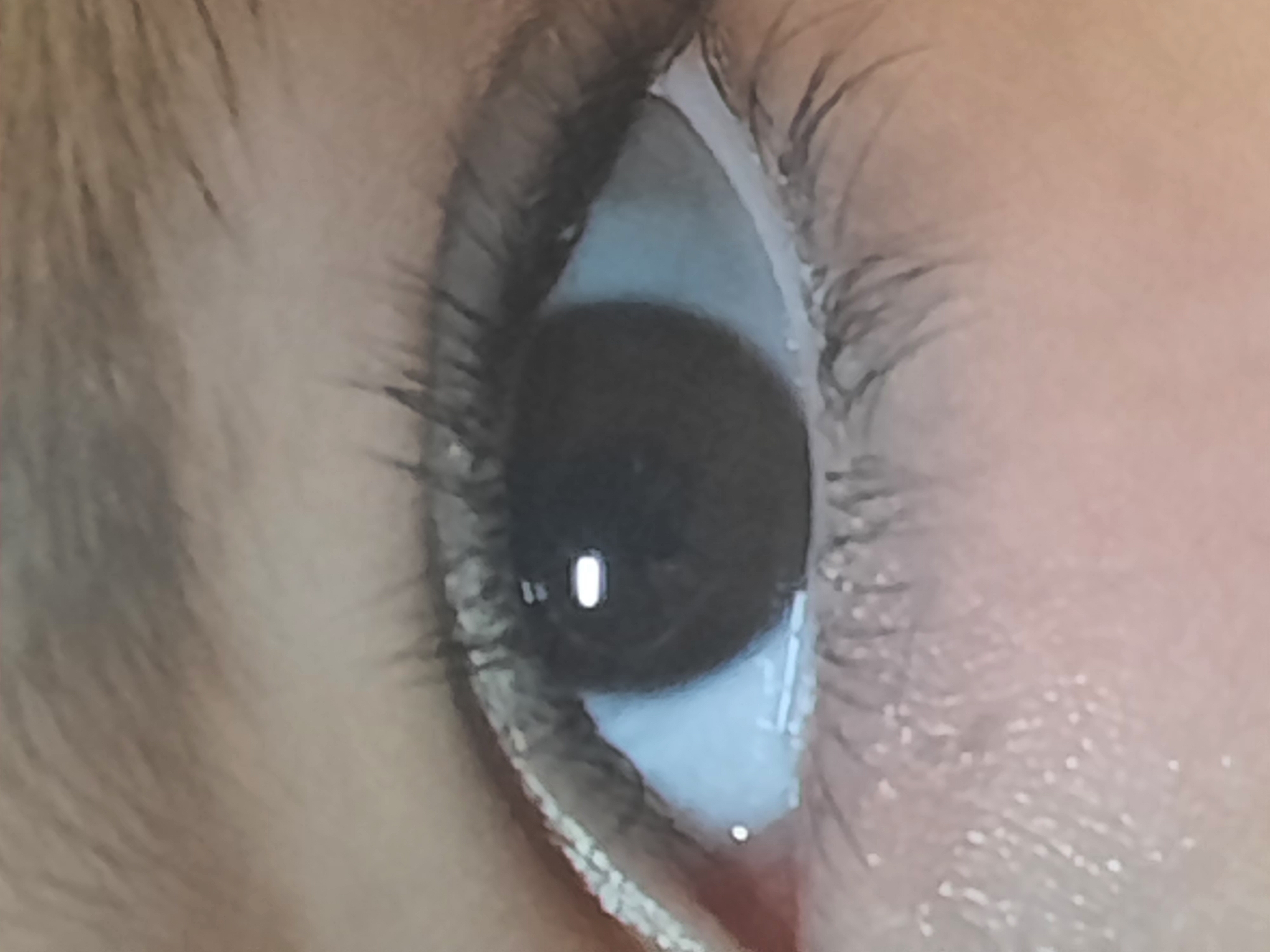 Close-up photograph of human eye captured by witness