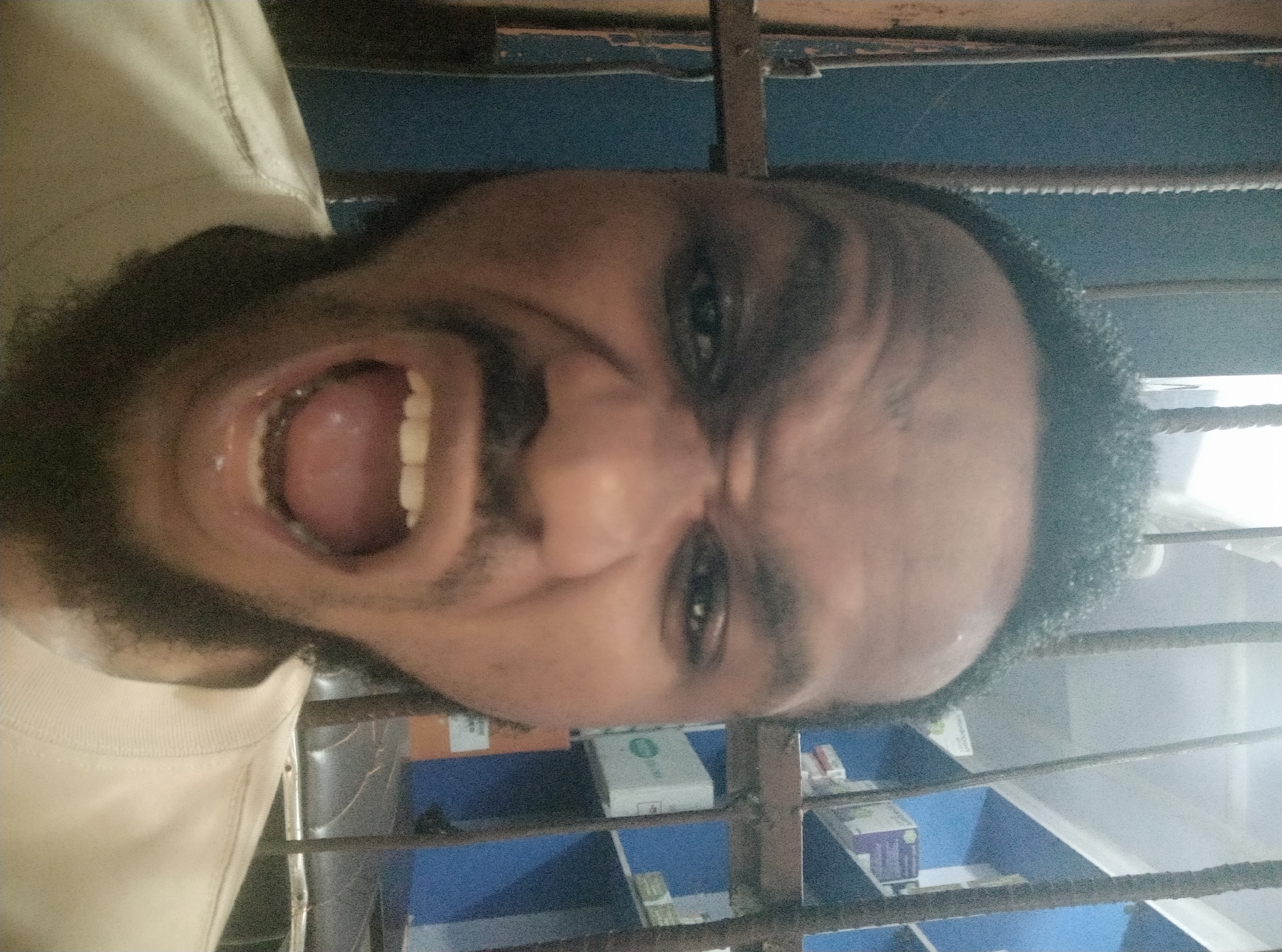 Bearded man photographed with mouth open in expressive moment