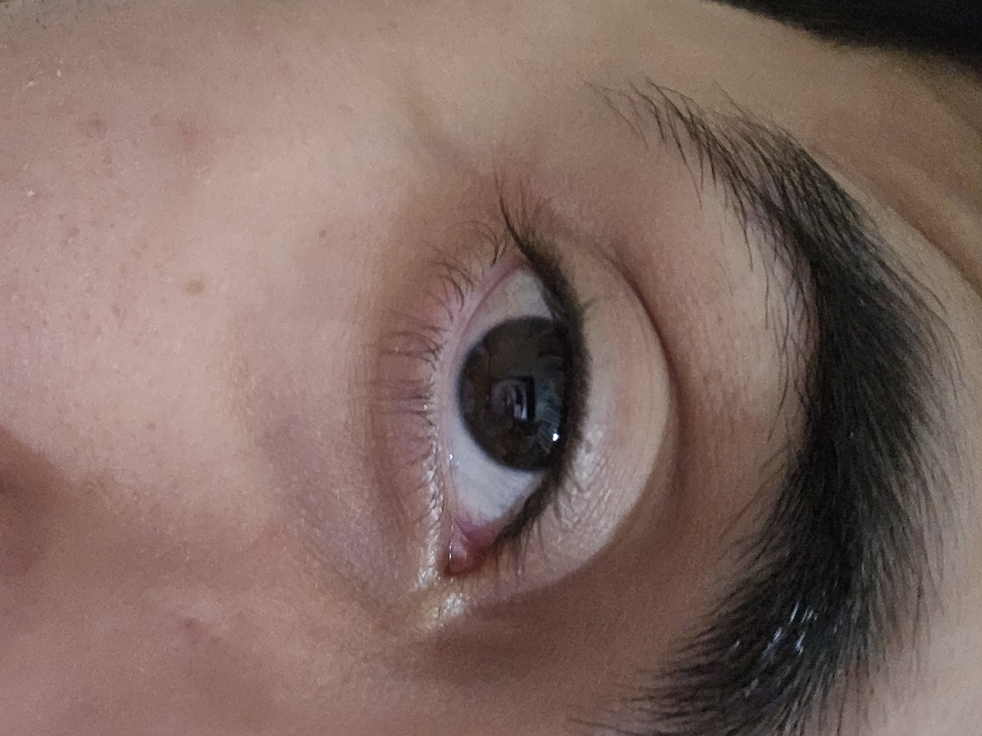Witness captures intimate moments: human eye, baby chick in Fez