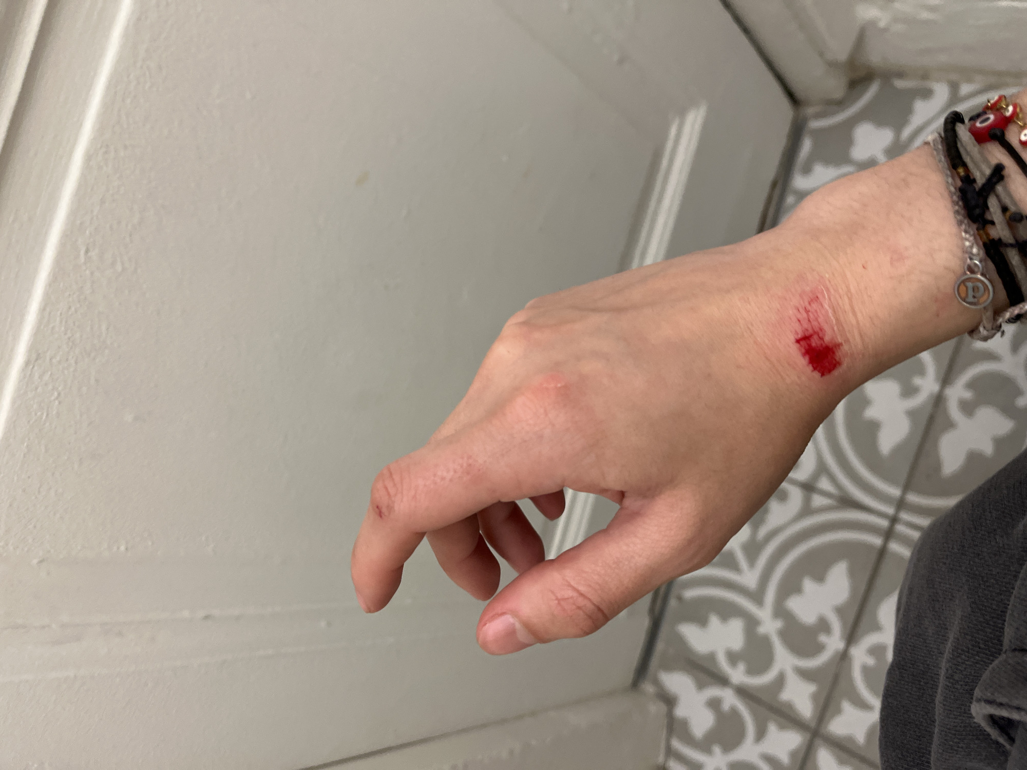 Injured person with bleeding wrist observed in Lyon