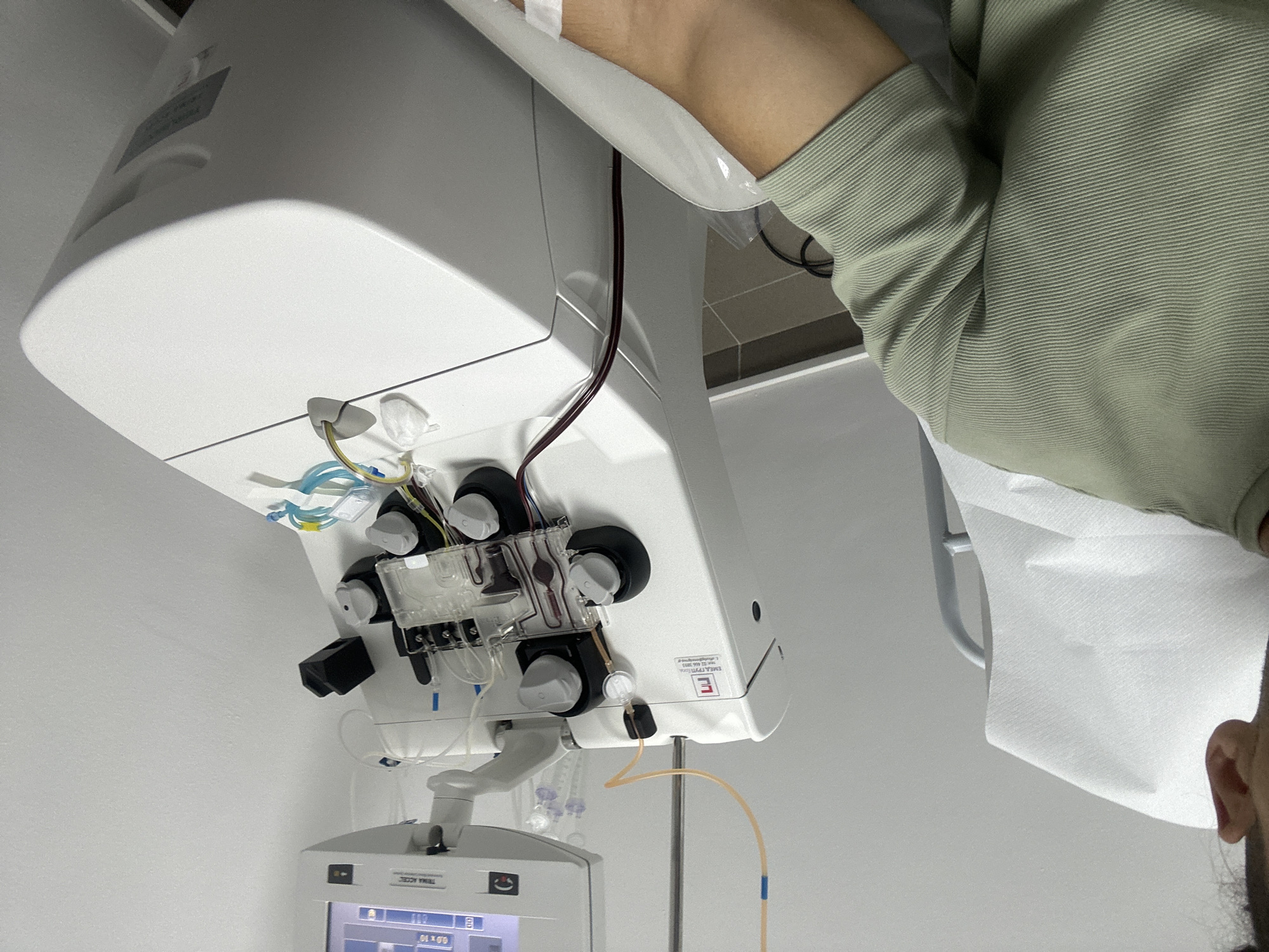 Apheresis or dialysis procedure underway in a Varna clinic