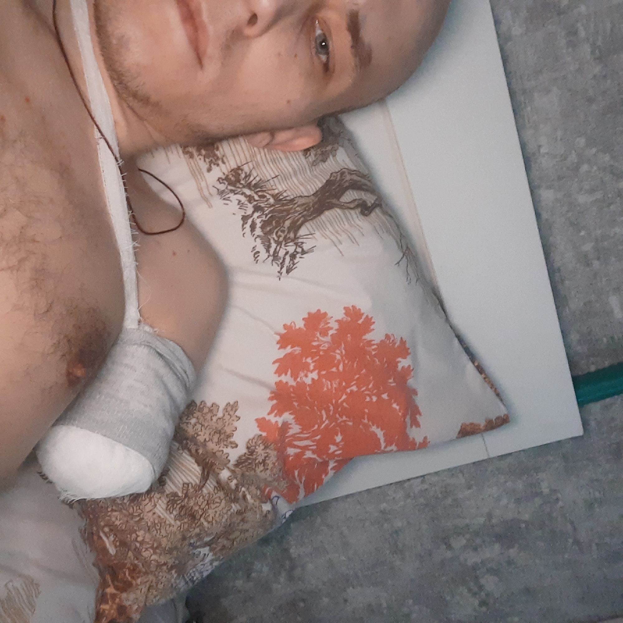 Injured man rests indoors with bandaged arm