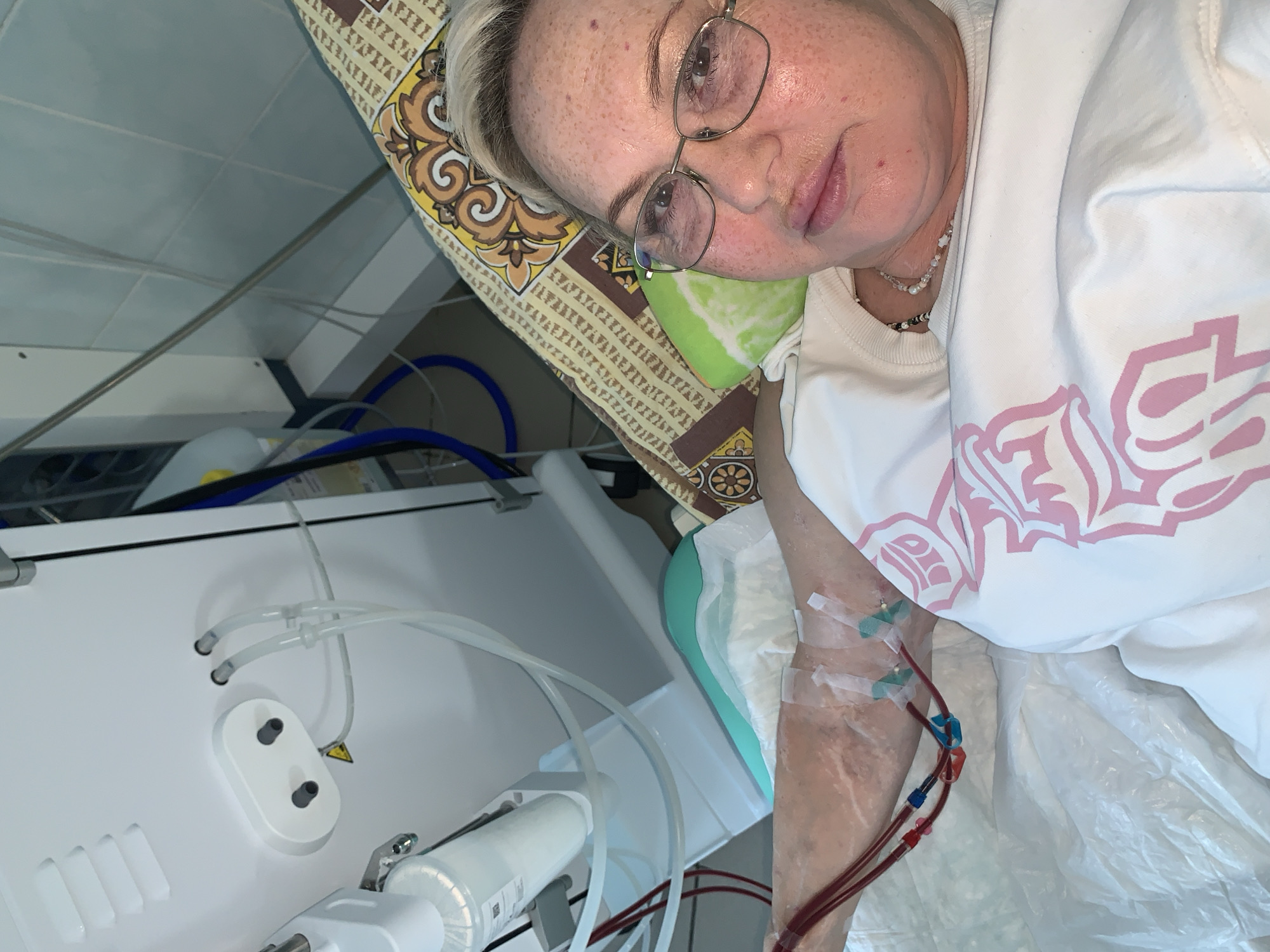 Dialysis treatments documented at Chaikovsky medical facility overnight