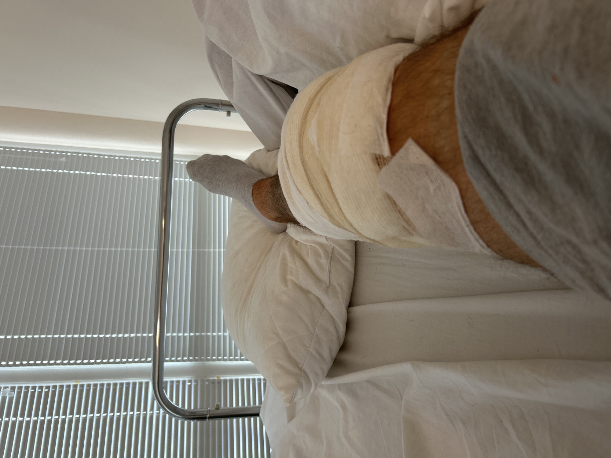 Bandaged leg recovery observed in Varna bedroom
