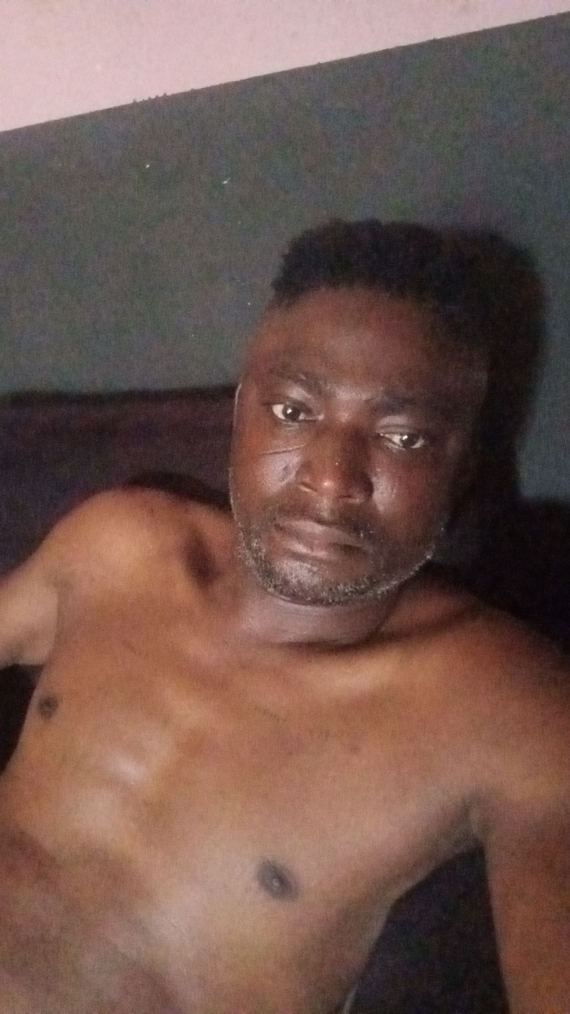 Man with facial scar observed resting in Sabon Tasha