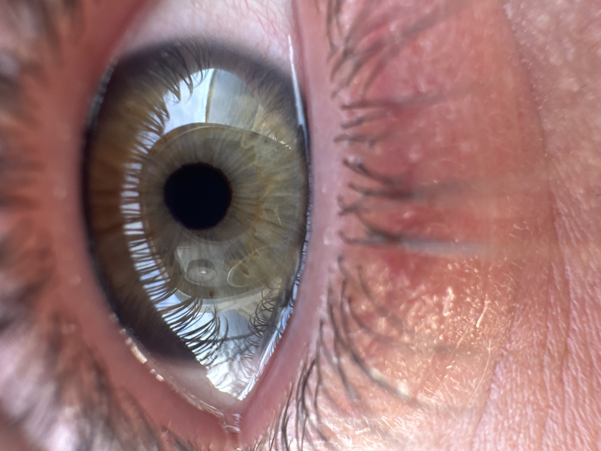 Close-up eye photography documented in Ivanovo, Russia