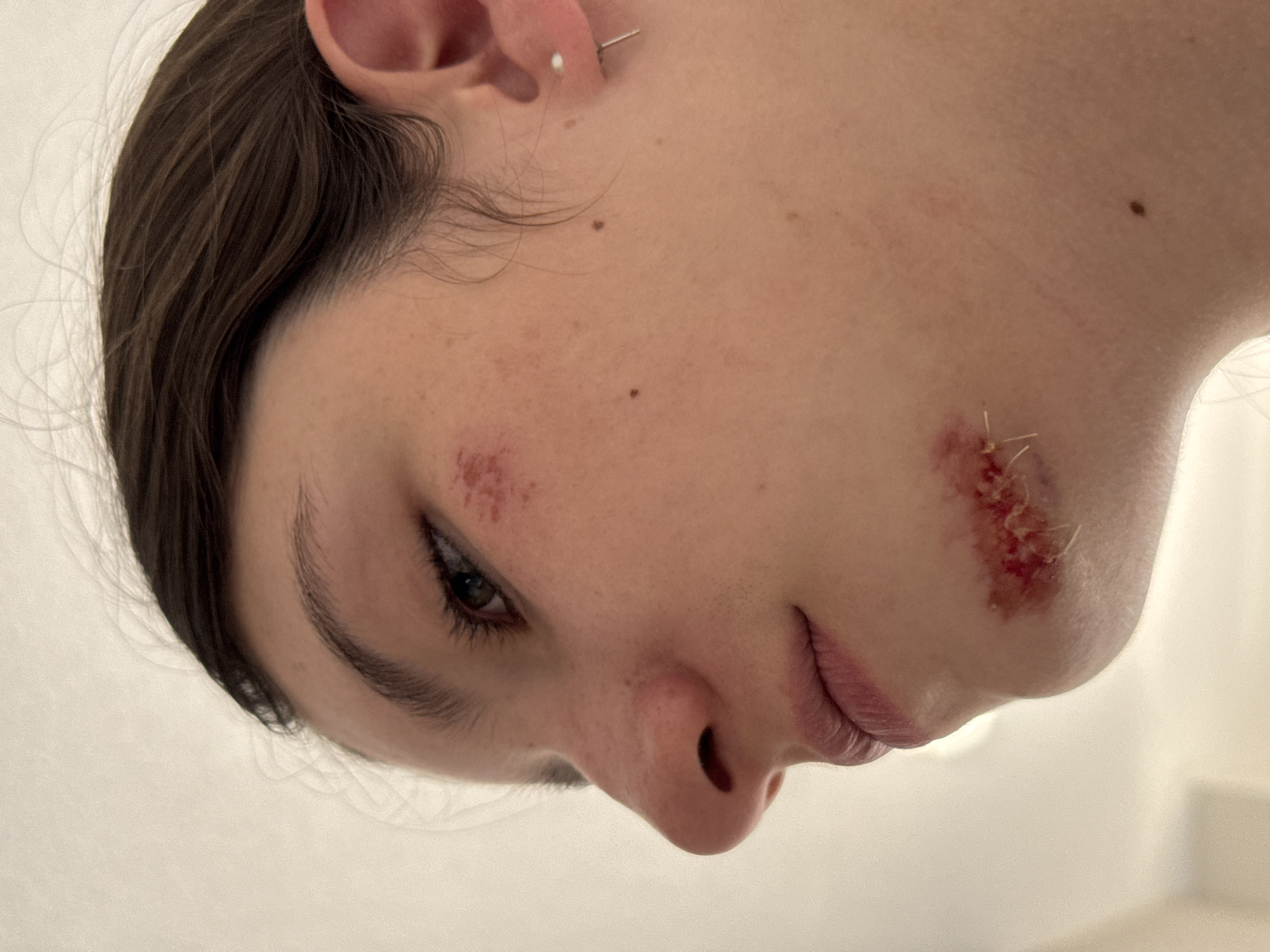 Facial injuries documented in Vancouver witness account