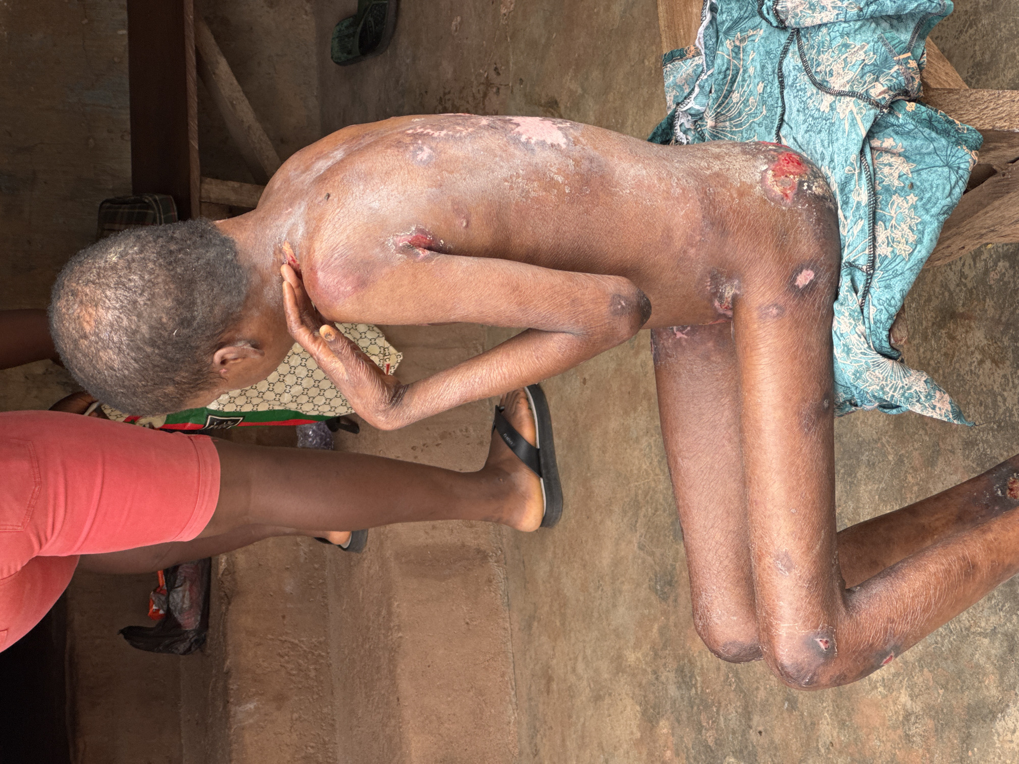 Everyday moments in Enugu, including injury and street-level life