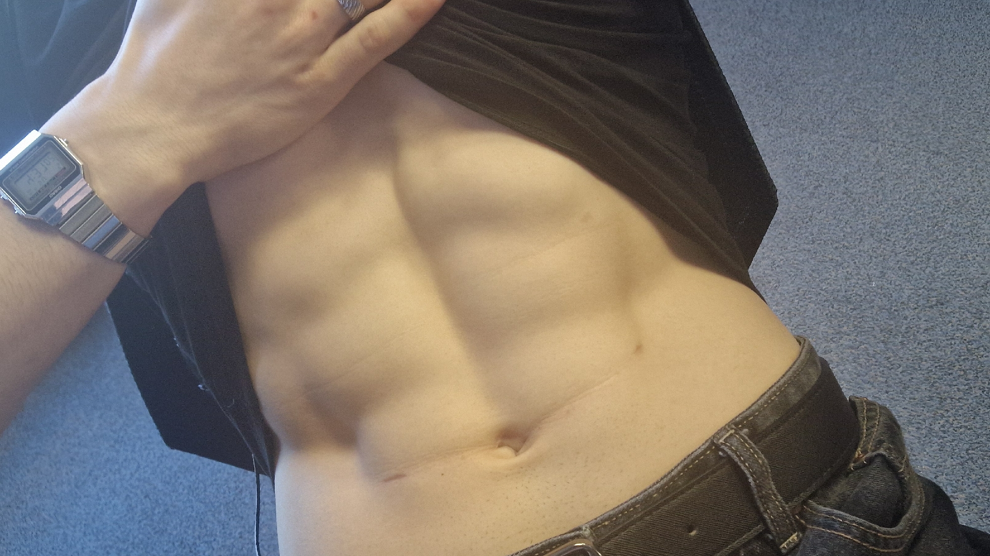 Person Shows Abdomen With Visible Scar Near Navel