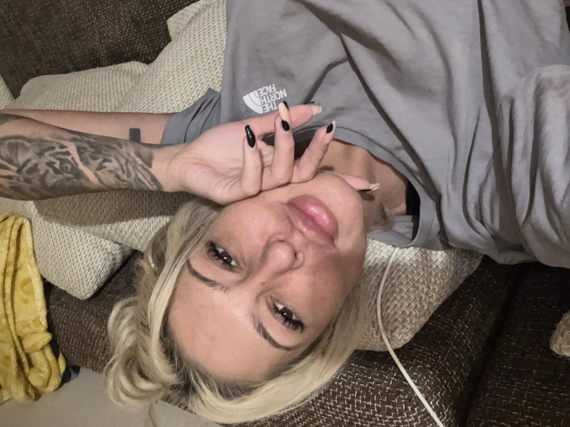 Woman with swollen lips photographed on couch in Plovdiv