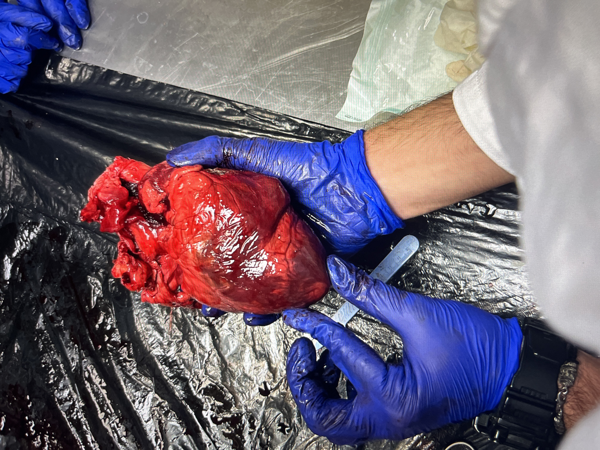 Medical examination involves human heart dissection, louse microscopy analysis