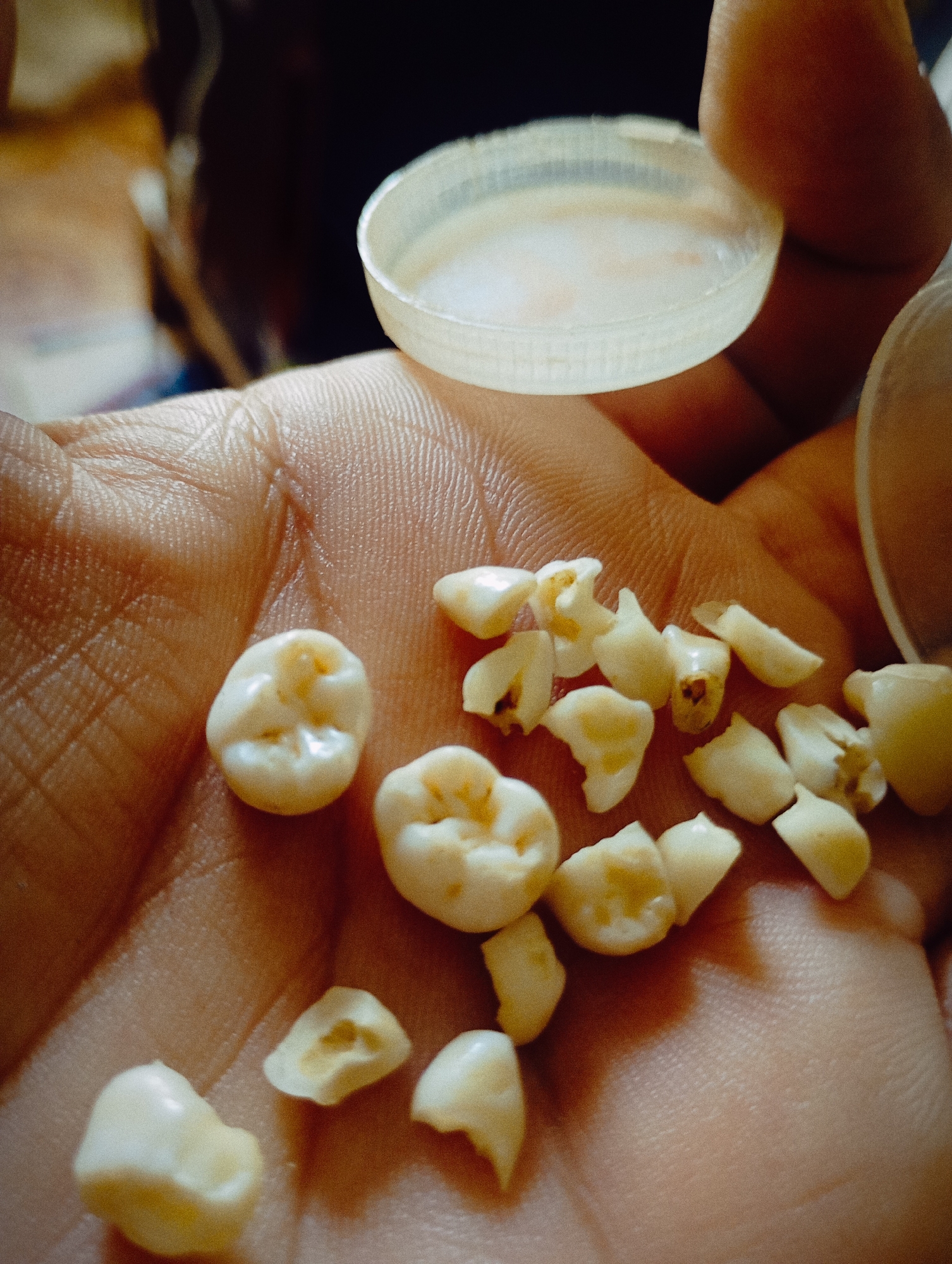 Person holds collection of loose teeth in Buenos Aires