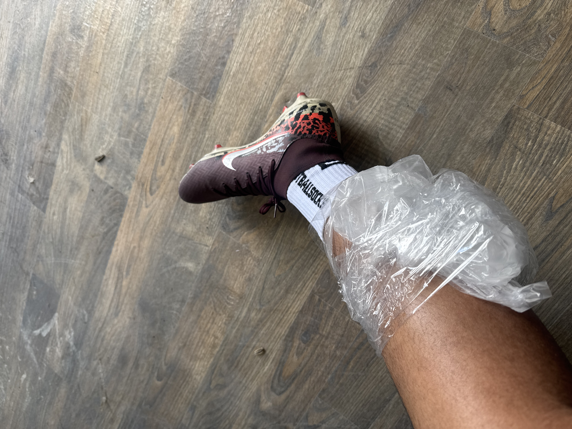 Soccer player treats leg injury with ice pack