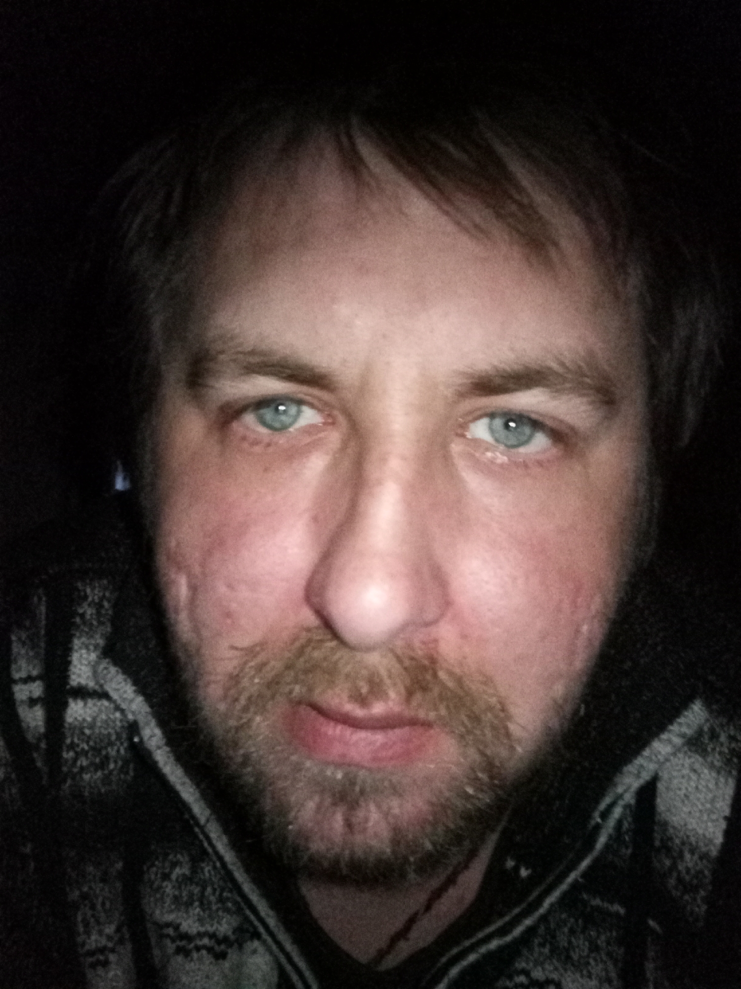 Close-up portrait of middle-aged man with facial scarring documented