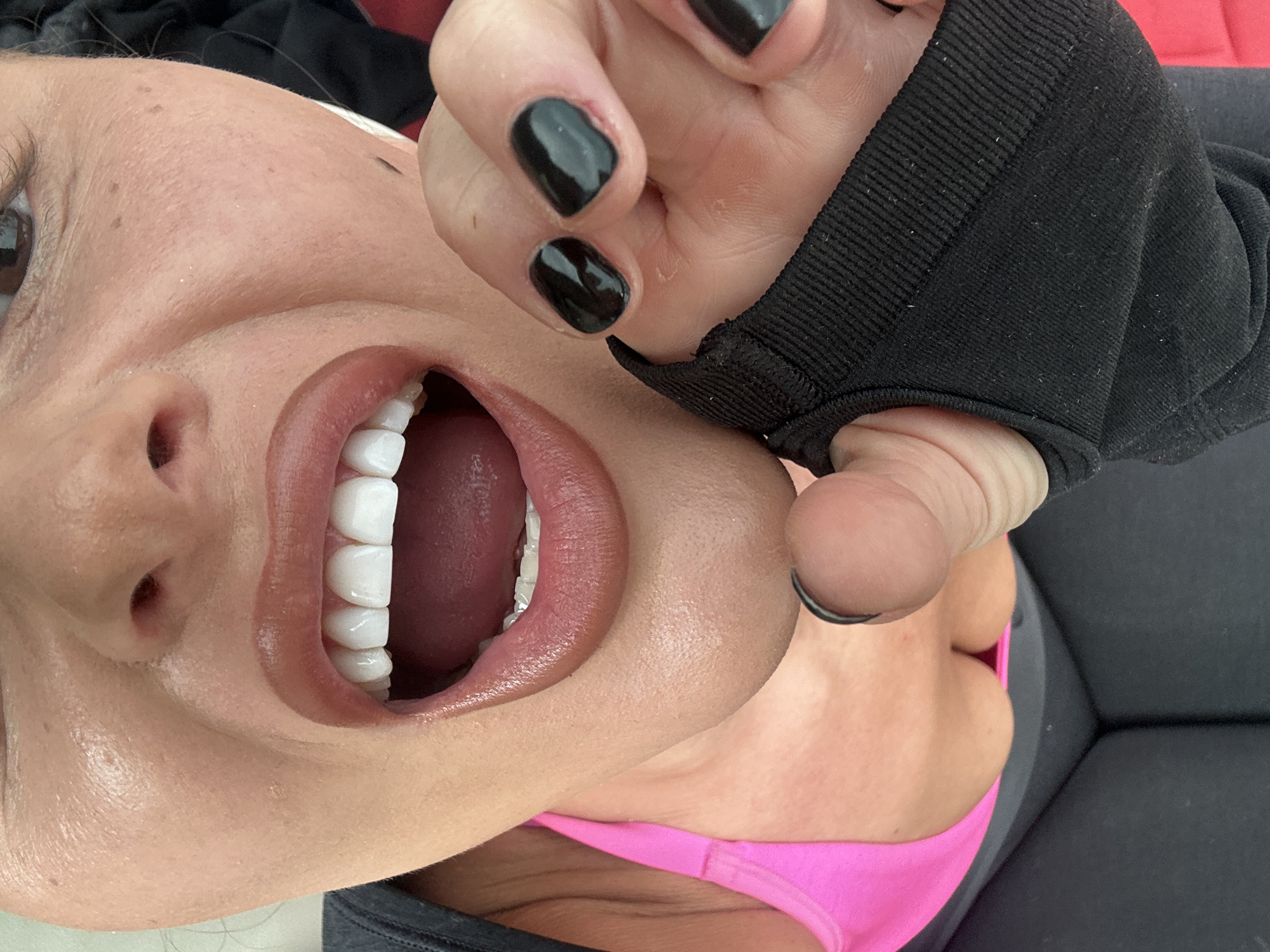 Bright open-mouthed smile, glossy lips, pink top, Tunbridge Wells