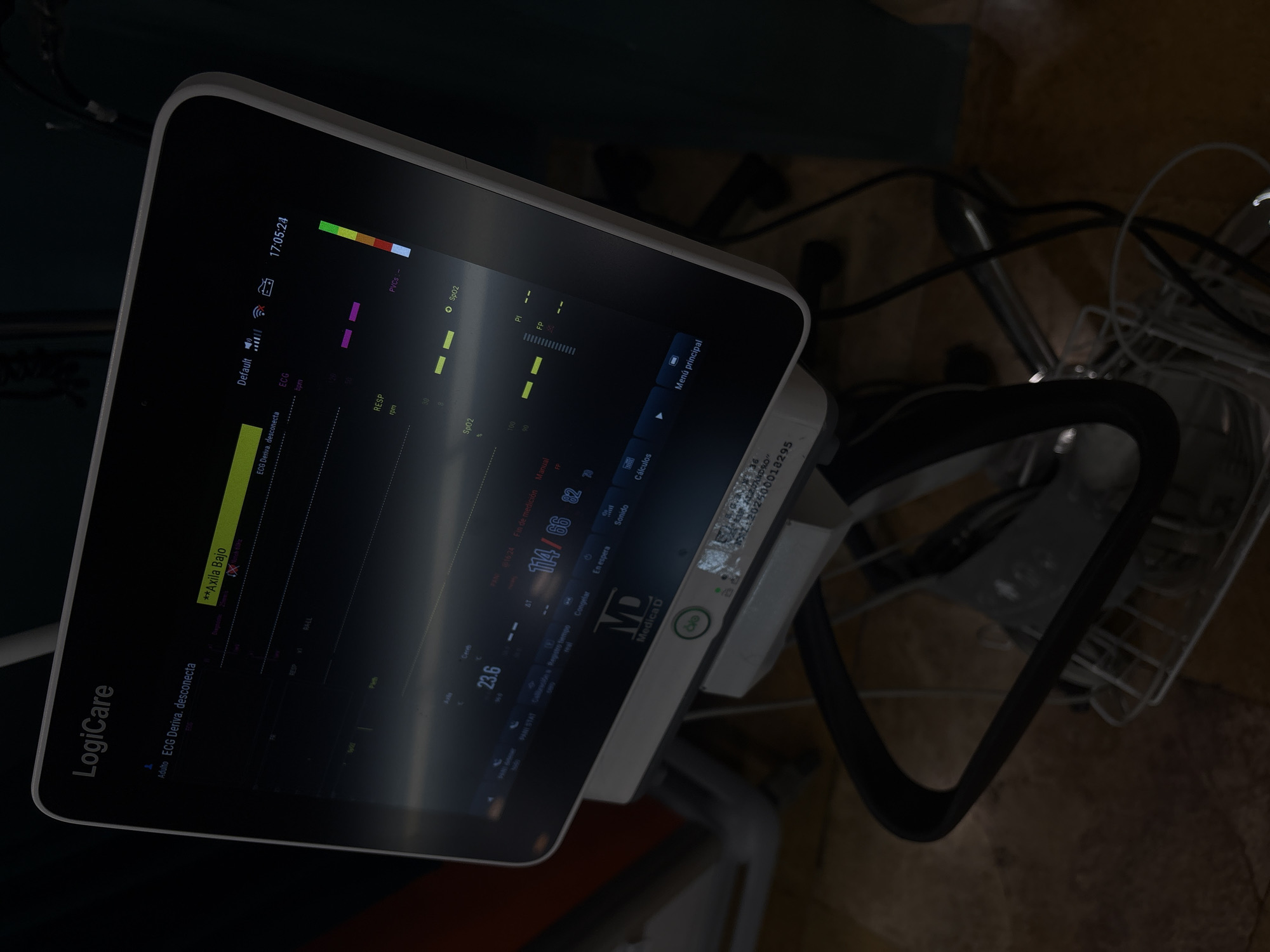 Medical monitor displays patient vitals in darkened Puebla facility