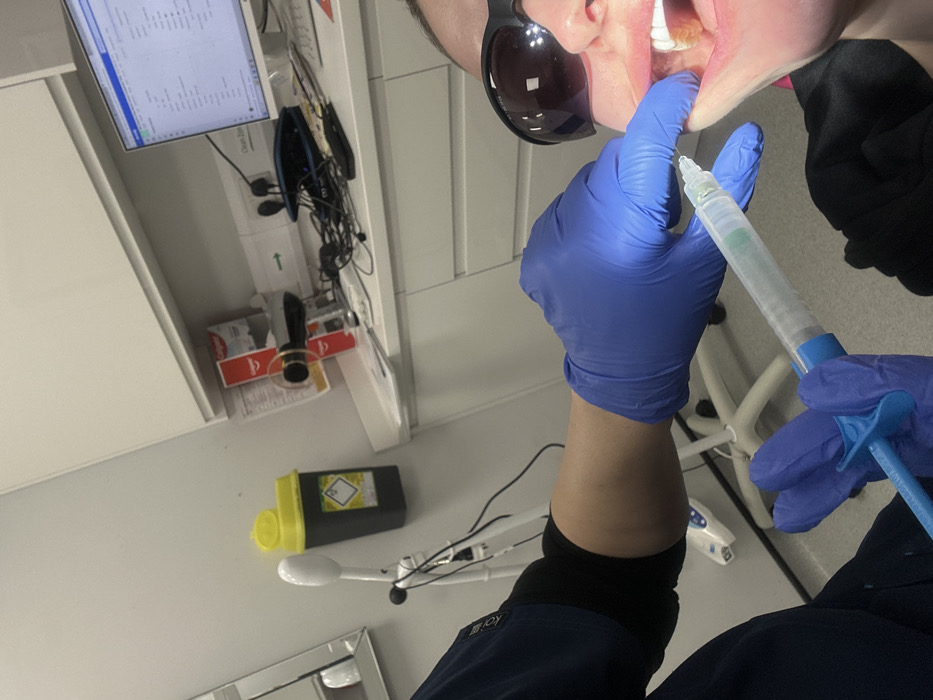 Dental procedure with digital modeling documented in Tunbridge Wells