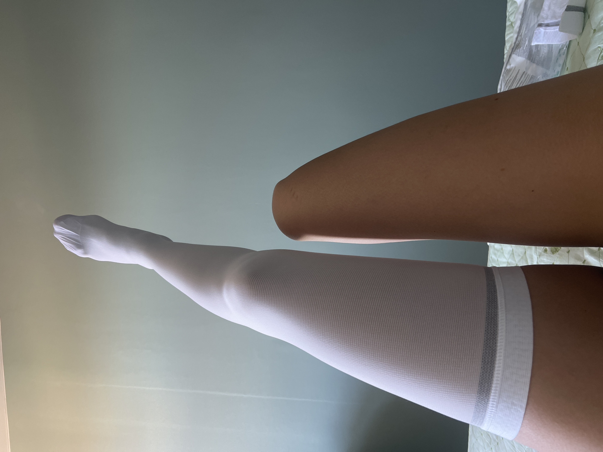 Person displays legs with compression stocking in Krasnoyarsk