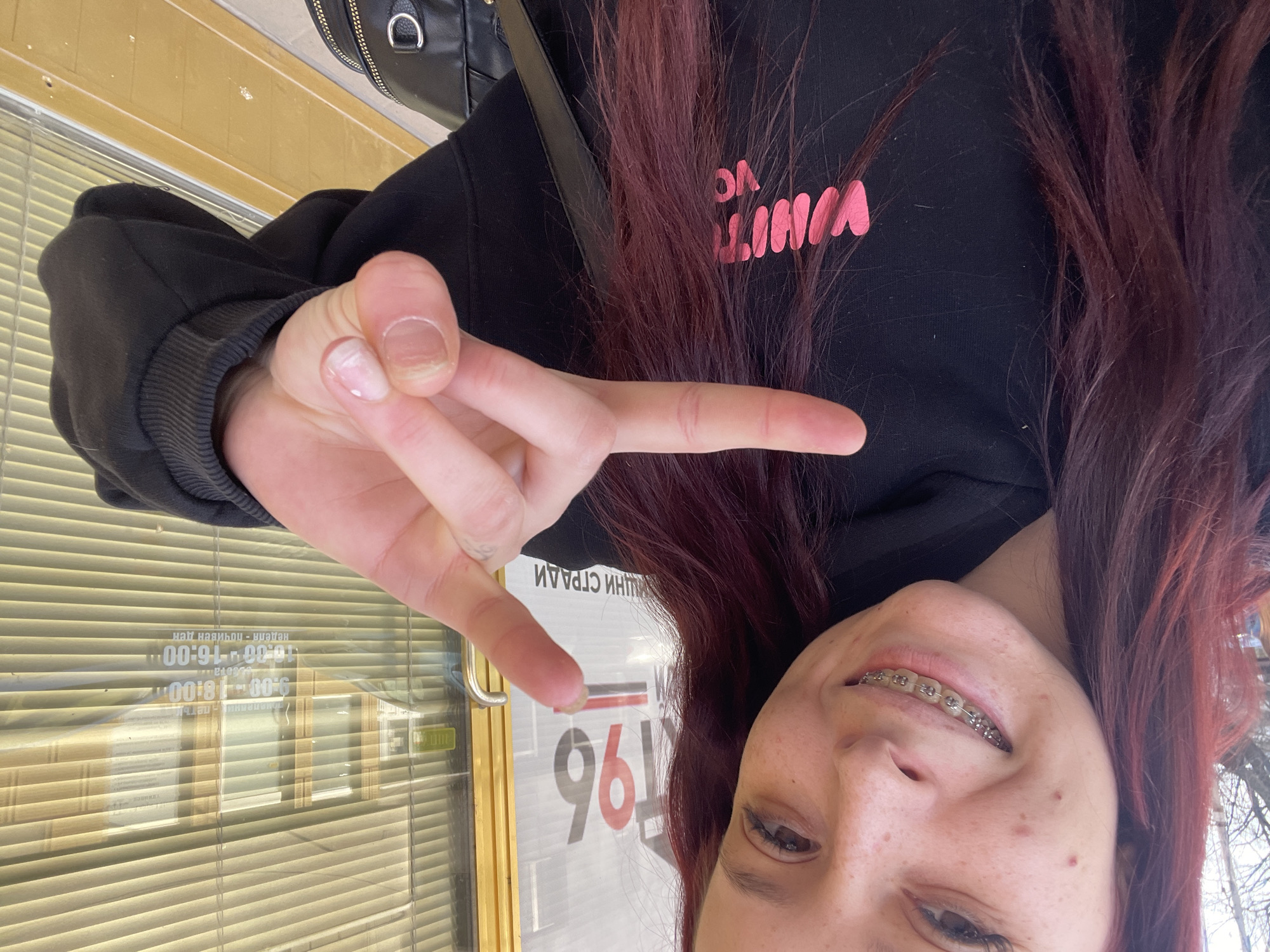 Casual indoor moments captured in Pernik: peace sign, injured knee