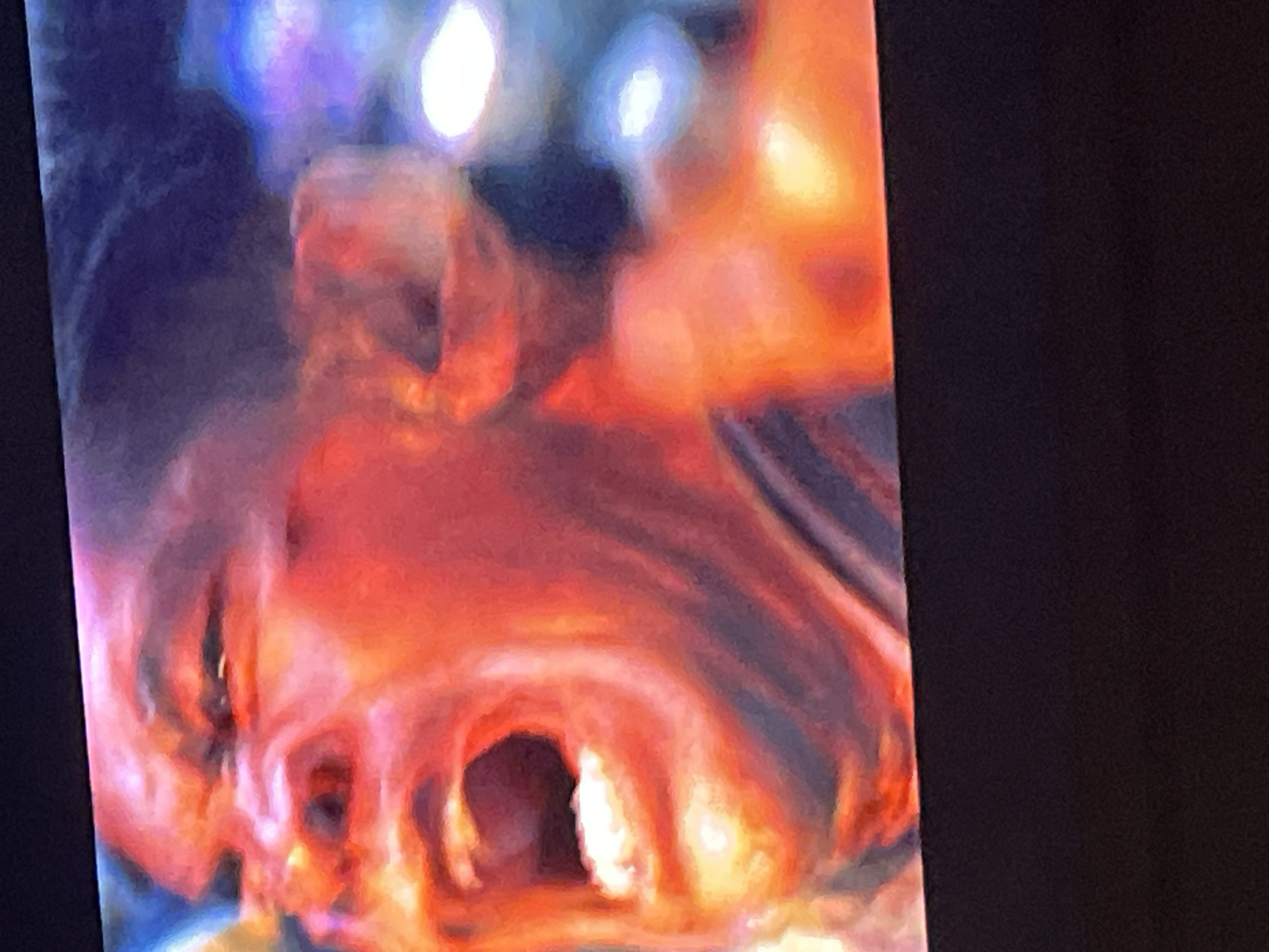 Medical endoscopy procedure documented in Buenos Aires