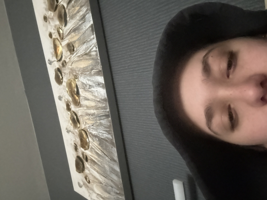 Sofia resident documents severe illness, headache on day five