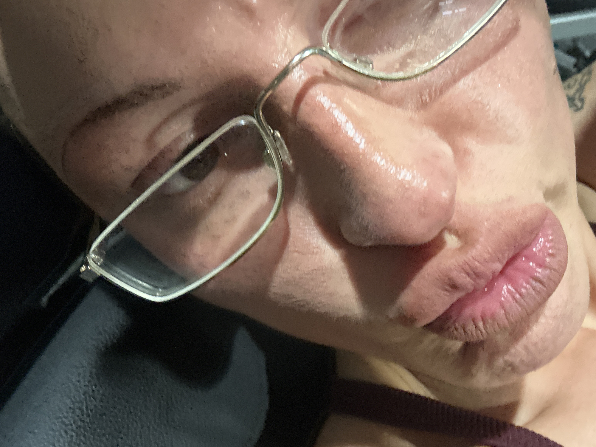 Person documents eye discomfort, missing contact lenses in Tunbridge Wells