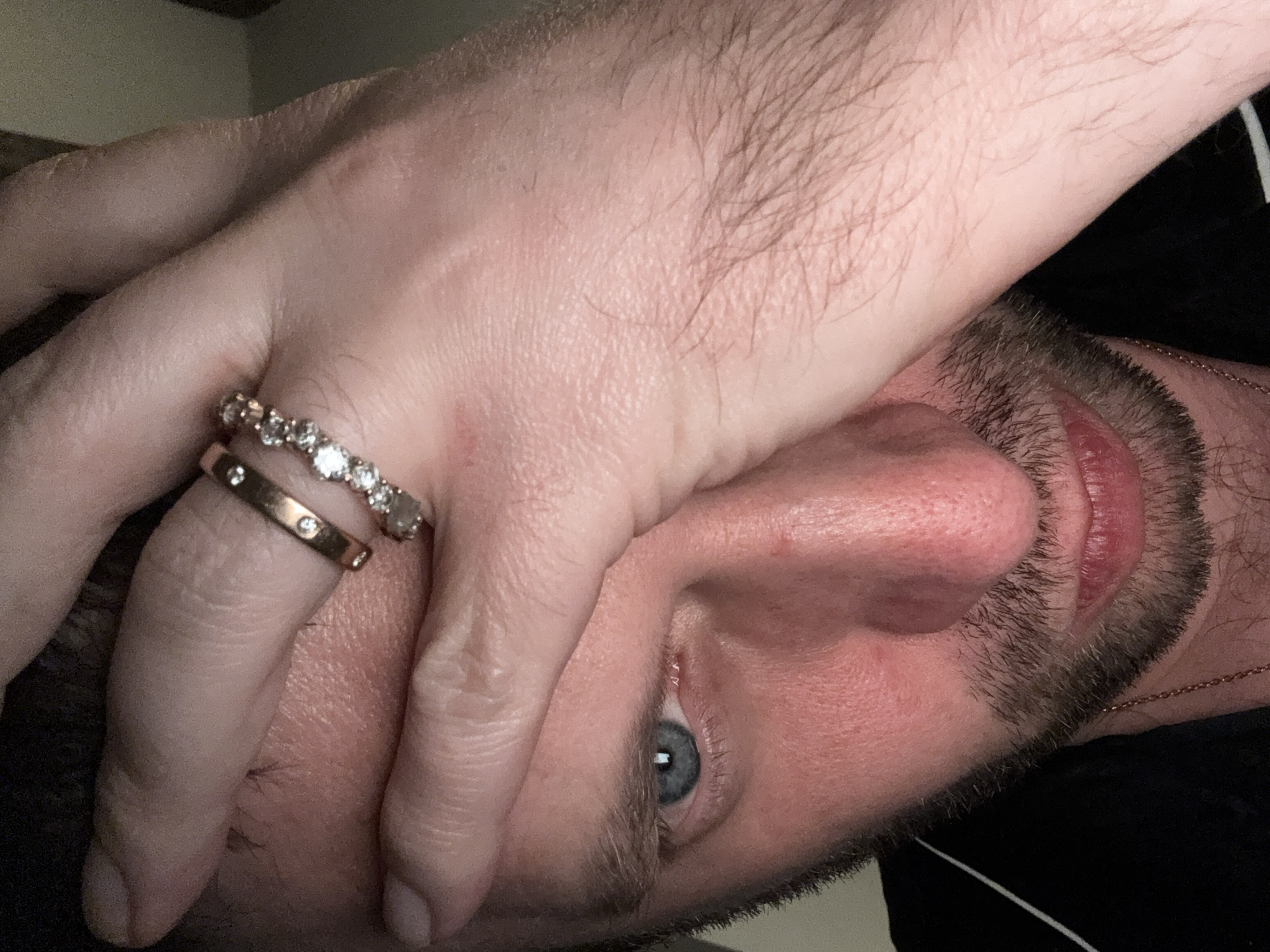 Close-up photos of unidentified man documented in Erba, Italy