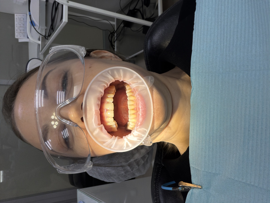 Woman undergoes dental procedure, documents experience through multiple perspectives