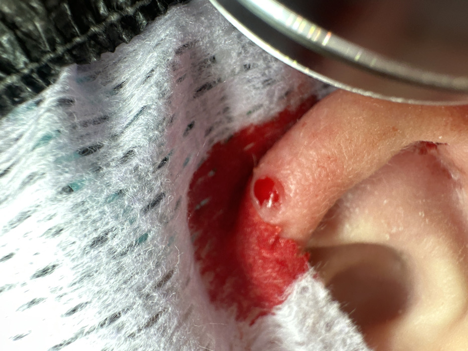 Person documents ear piercing procedure in Saratov, Russia