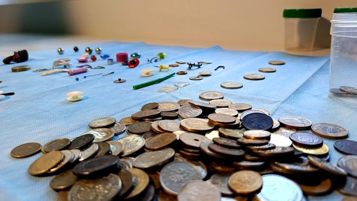 To mogło zabić! Gwoździe, bombki i kulki magnetyczne w brzuchach dzieci