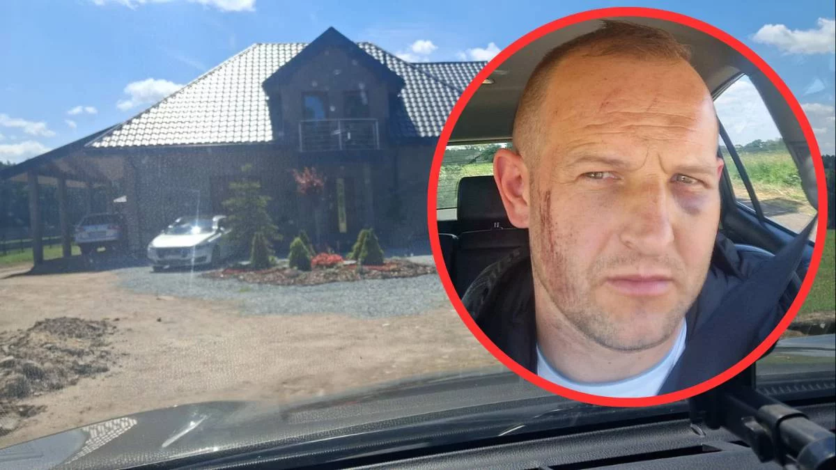 Funkcjonariusze z Gorzkowic brutalnie pobili mężczyznę na jego posesji? „Dostałem z nogi w twarz”