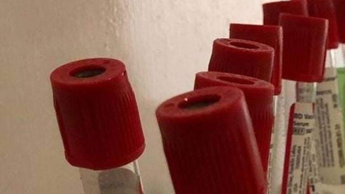 “No ha habido respuesta”: Grupo CAVA denuncia presunto acto de discriminación a joven con VIH en el Hospital Hidalgo