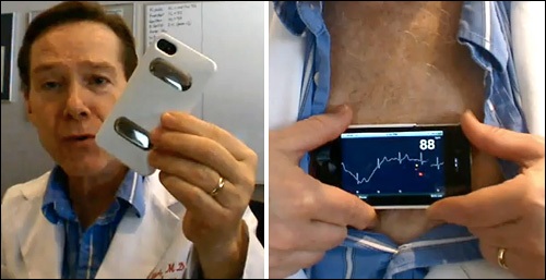 iPhonECG promění váš iPhone 4 na EKG přístroj [video]