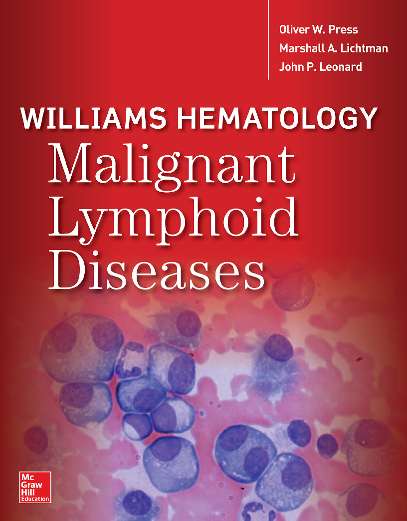 Williams Hematology Malignant Lymphoid Diseases