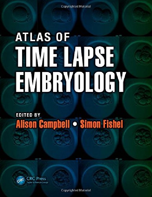 Atlas of Time Lapse Embryology by Alison Campbell, Simon Fishel