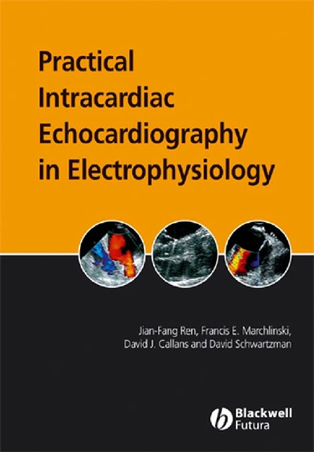 Practical-Intracardiac-Echocard - HELF eBook Library