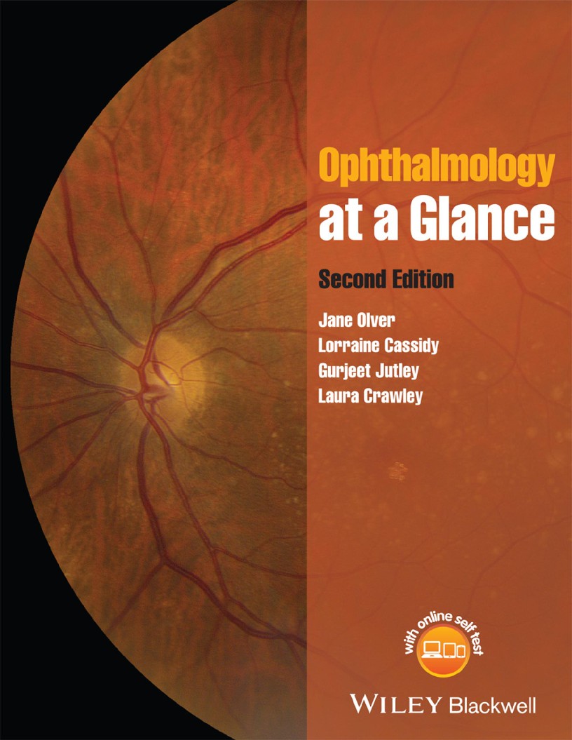 Ophthalmology at a Glance 2nd Ed