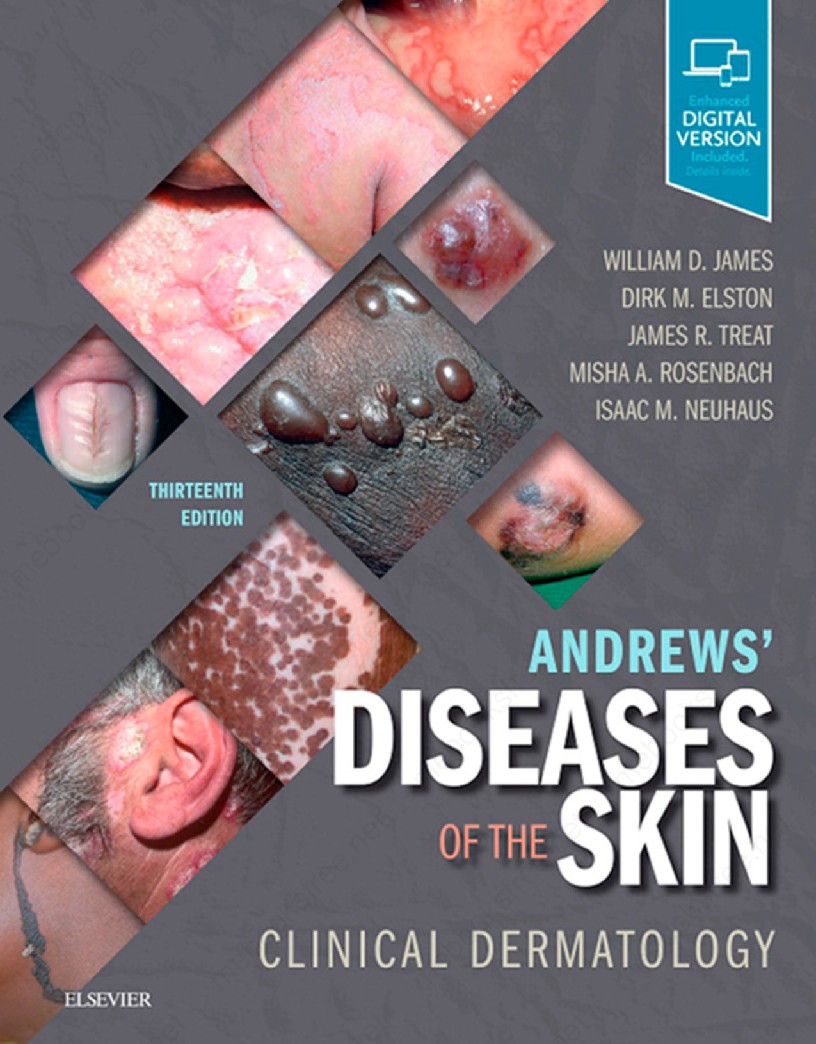 Andrews’ Diseases of the Skin Clinical Dermatology by William D