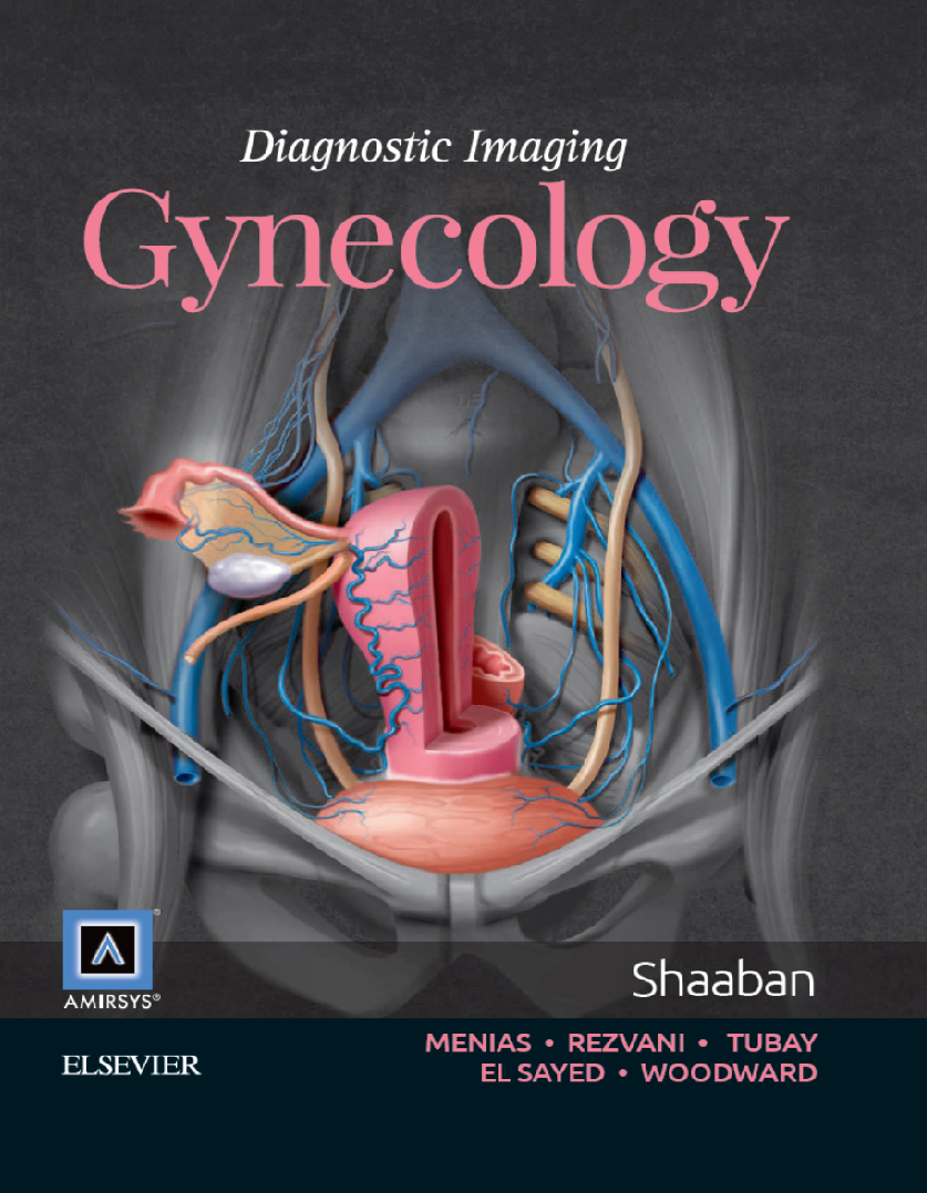 Diagnostic Imaging Gynecology by Akram M Shaaban