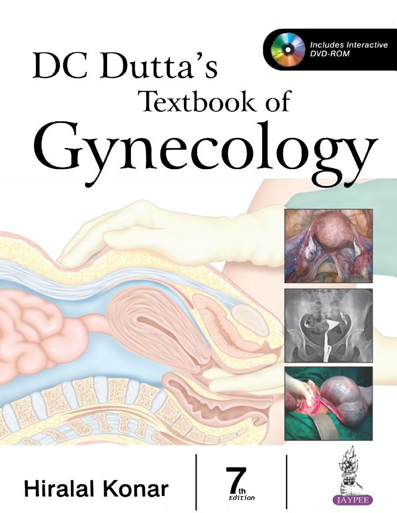 DC Duttas textbook of gynecology (including contraception) 7th Ed